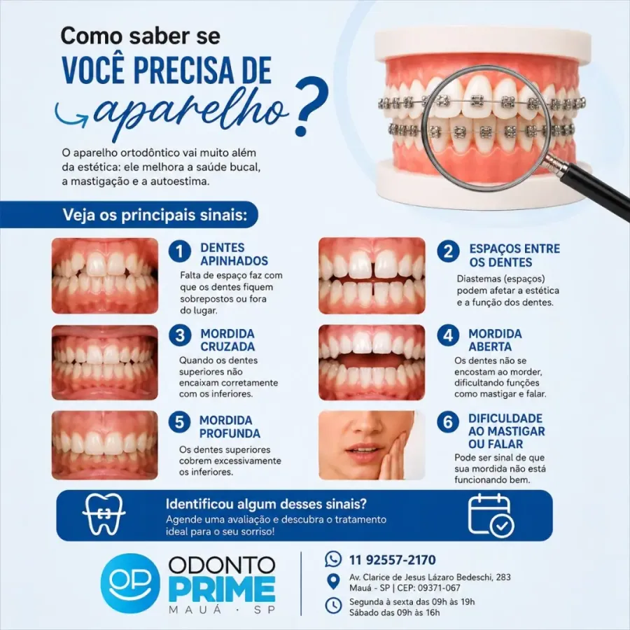 Sinais de que você precisa de aparelho ortodôntico