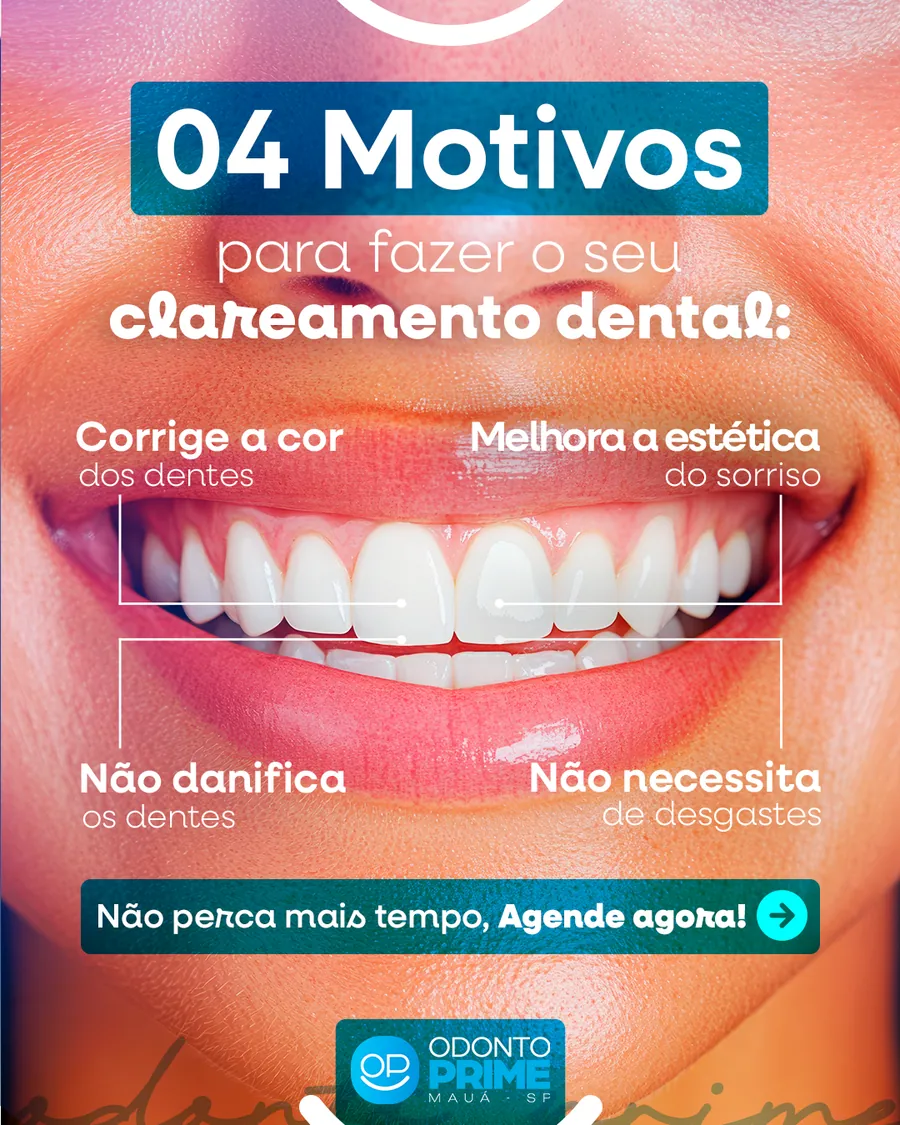 Quatro motivos para fazer clareamento dental