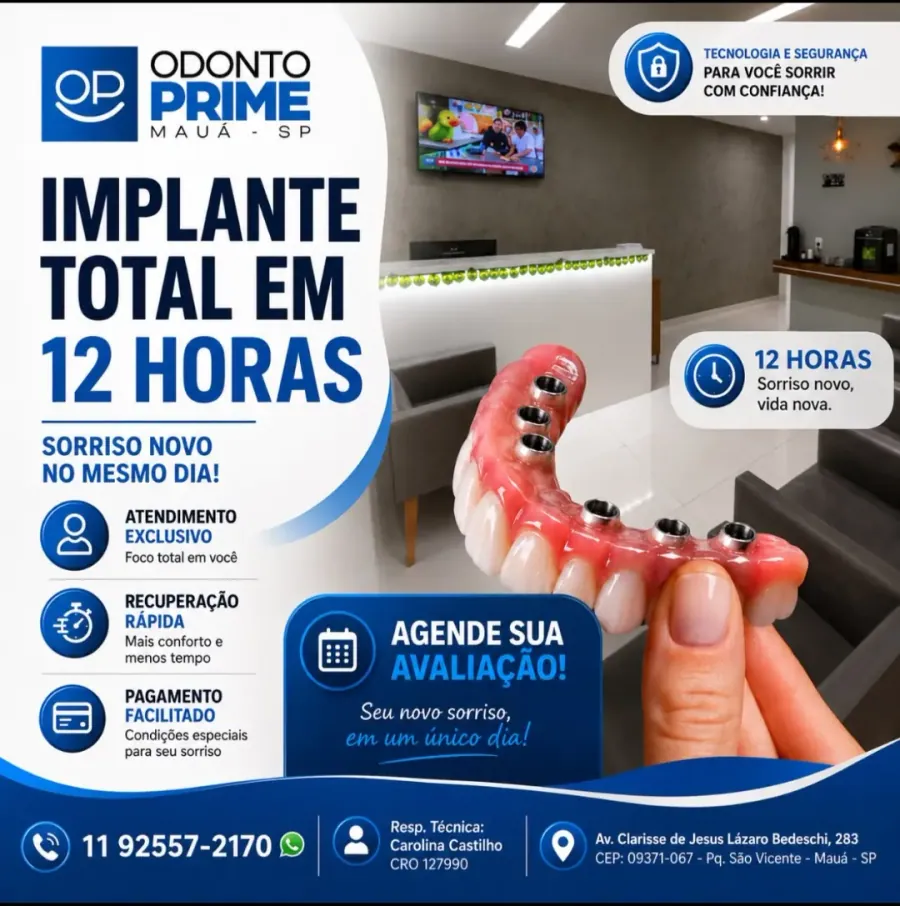 Arte da Odonto Prime sobre implante total em até 12 horas