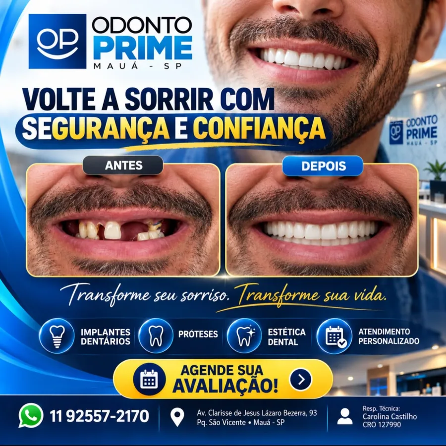 Arte da Odonto Prime sobre implantes e próteses dentárias