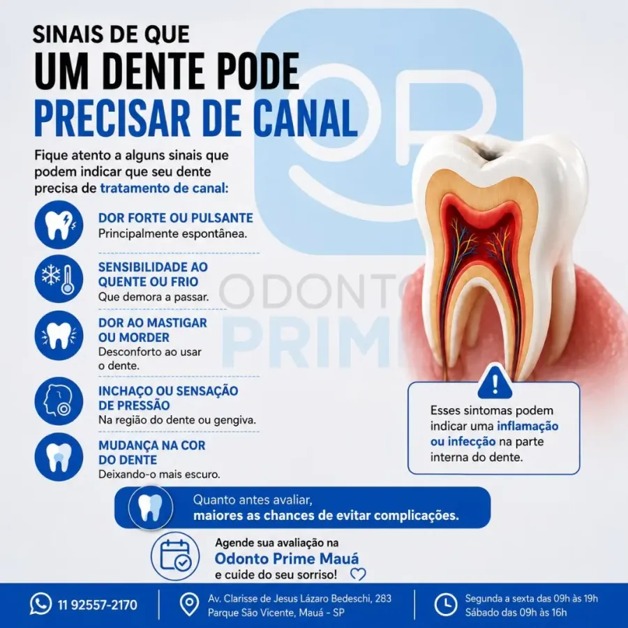 Sinais de que um dente pode precisar de tratamento de canal